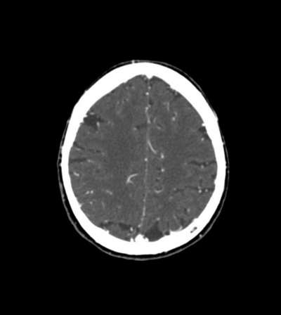 Fantoma de Cabeça/Pescoço