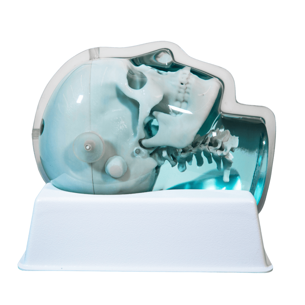 SRS MR distortion phantom image