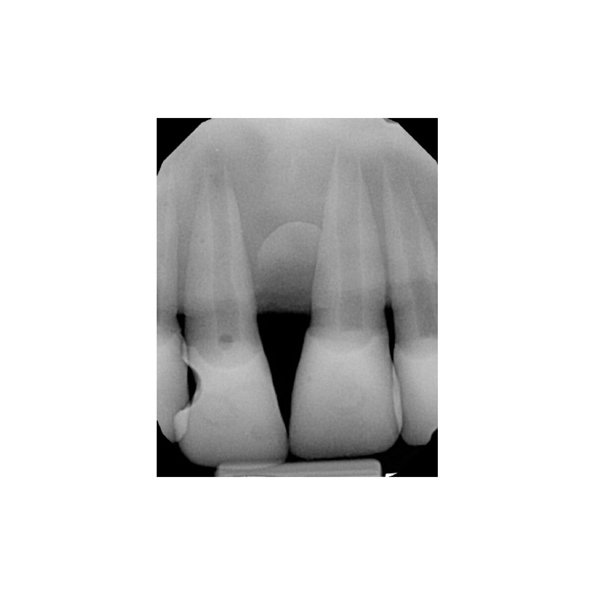 Fantoma para Avaliação, Teste e Verificação de Radiografia Intraoral
