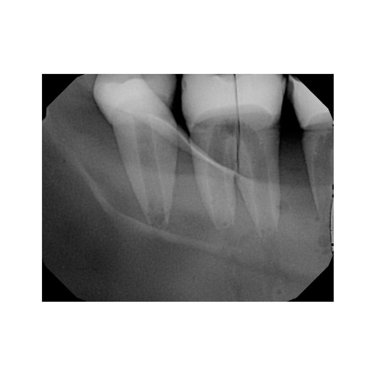 Fantoma para Avaliação, Teste e Verificação de Radiografia Intraoral