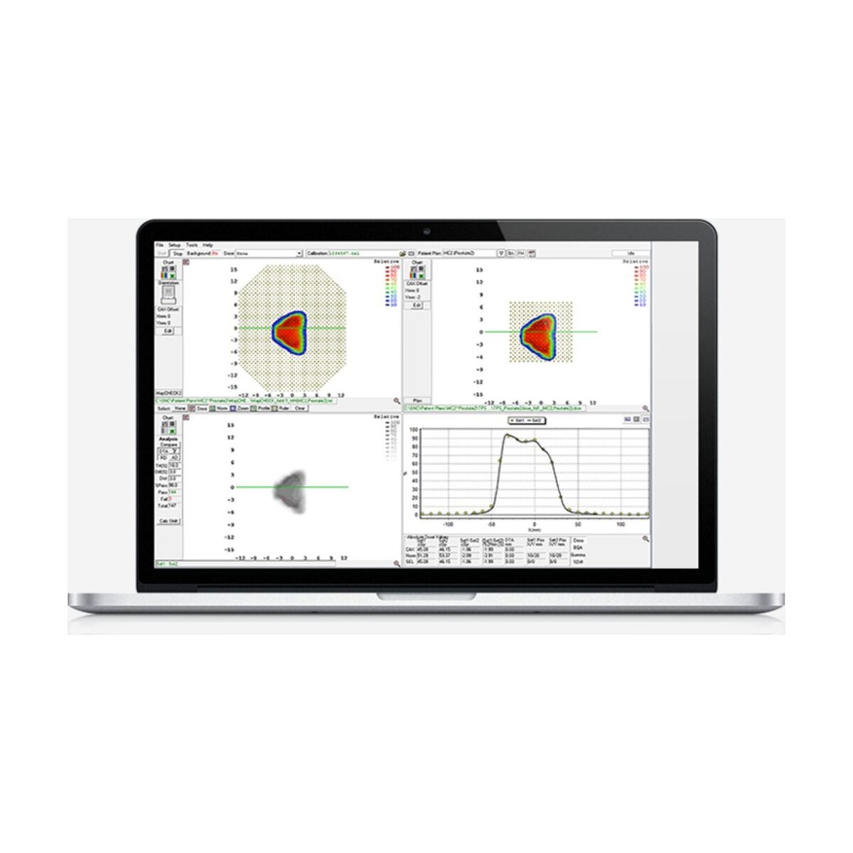 MapCHECK 3