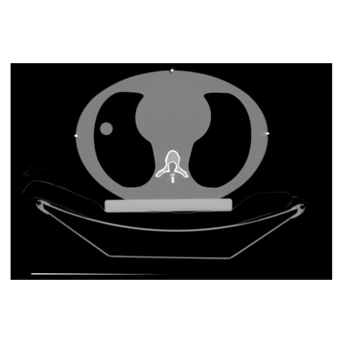 Motion Management QA Phantoms