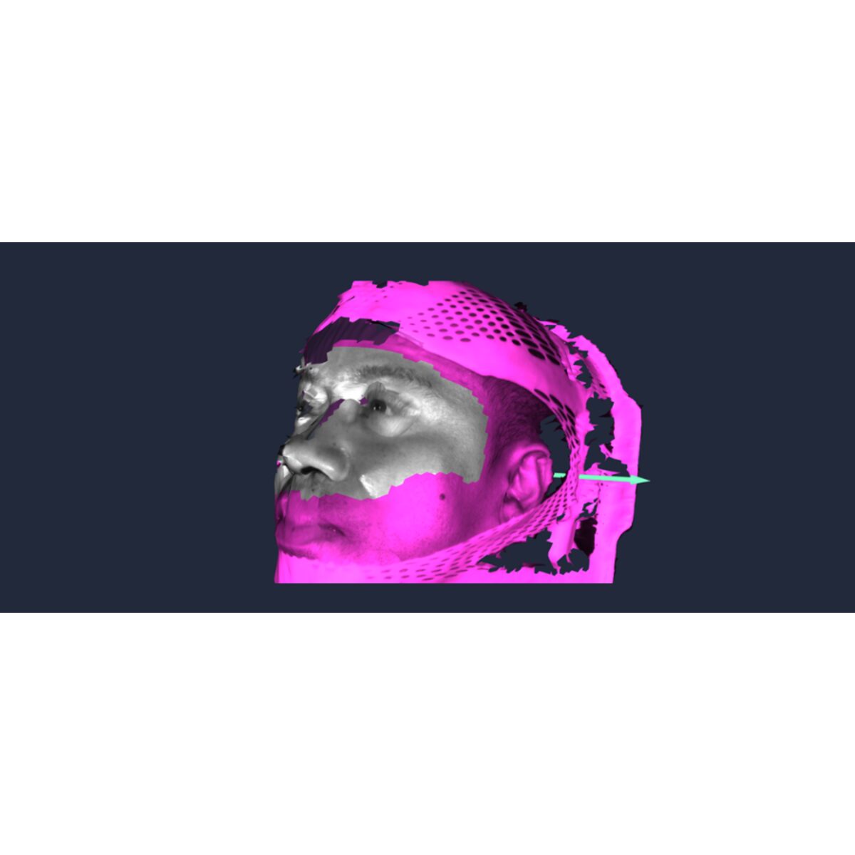 AlignRT