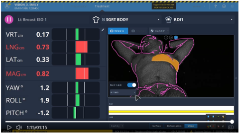 Beam Guide™