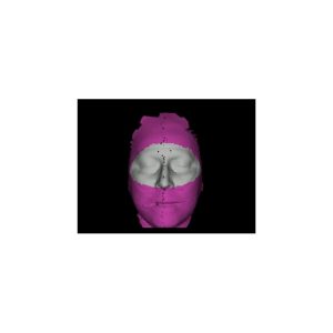 Auto ROI™ Module