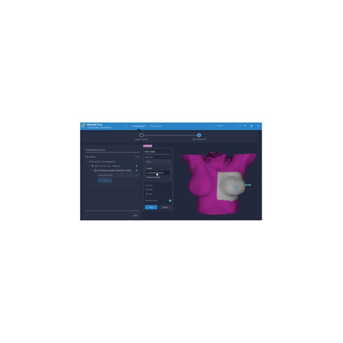 Auto ROI™ Module